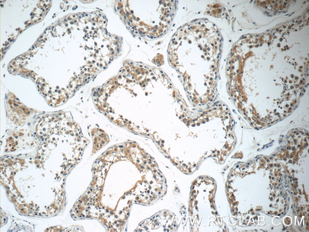 Immunohistochemistry (IHC) staining of human testis tissue using GKAP1 Polyclonal antibody (11395-1-AP)