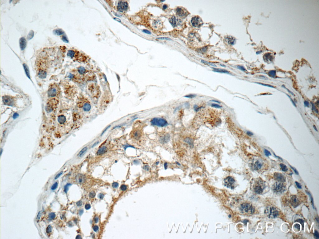 Immunohistochemistry (IHC) staining of human testis tissue using GKAP1 Polyclonal antibody (11395-1-AP)