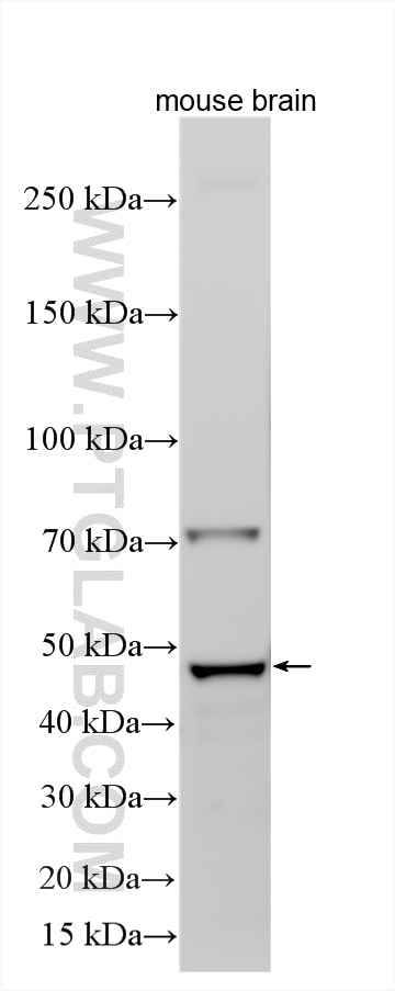 WB analysis using 11395-1-AP Western Blot (WB) analysis of various lysates using GKAP1 Polyclonal antibody (11395-1-AP)