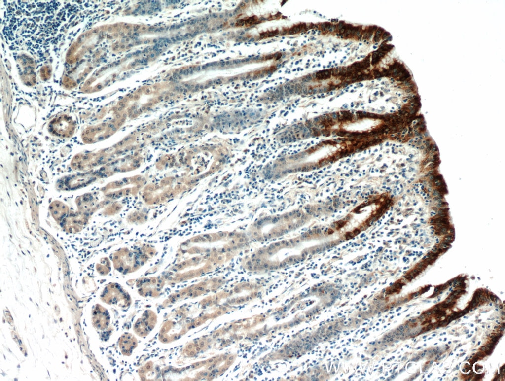 Immunohistochemistry (IHC) staining of human stomach tissue using Gastrokine 1 Polyclonal antibody (14494-1-AP)