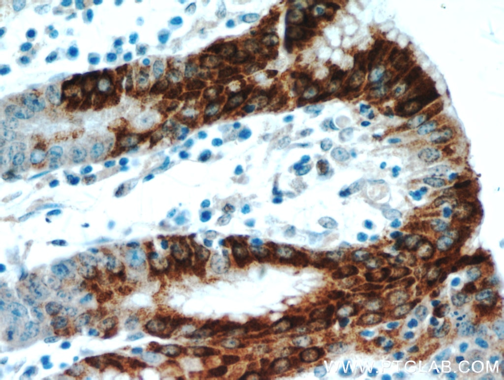 IHC staining of human stomach using 14494-1-AP