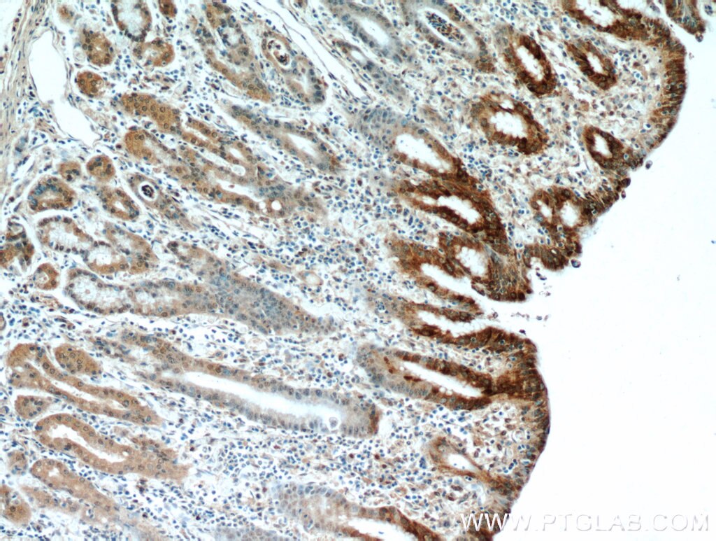 Immunohistochemistry (IHC) staining of human stomach tissue using Gastrokine 1 Polyclonal antibody (14494-1-AP)