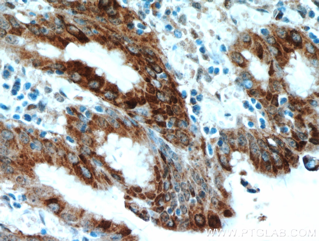 Immunohistochemistry (IHC) staining of human stomach tissue using Gastrokine 1 Polyclonal antibody (14494-1-AP)