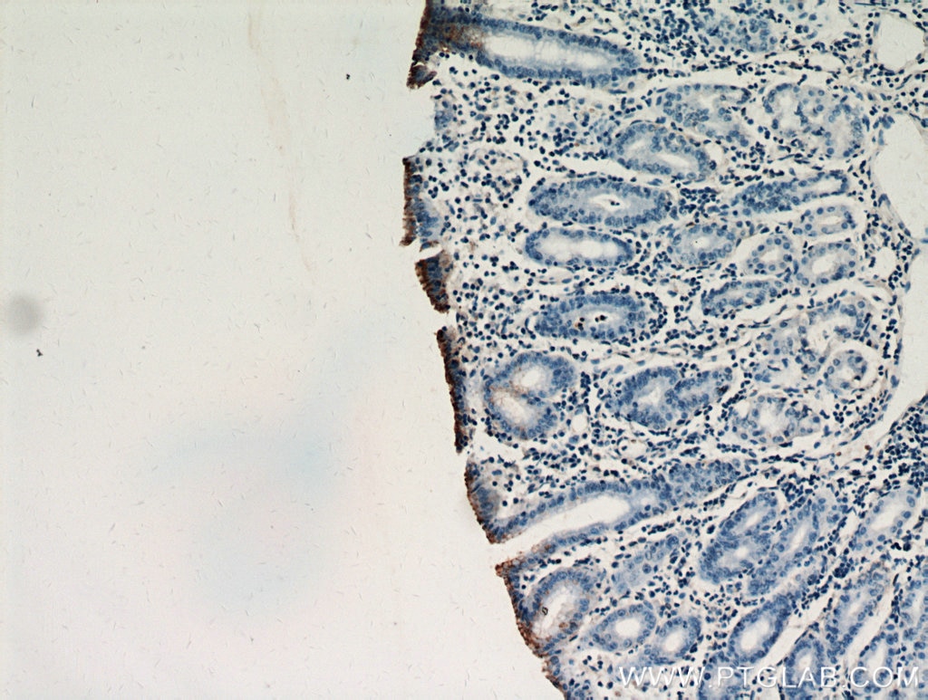 Immunohistochemistry (IHC) staining of human stomach tissue using Gastrokine 1 Polyclonal antibody (14494-1-AP)