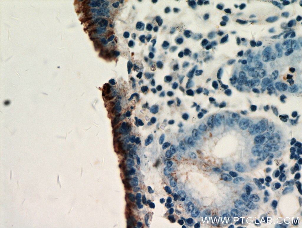 Immunohistochemistry (IHC) staining of human stomach tissue using Gastrokine 1 Polyclonal antibody (14494-1-AP)