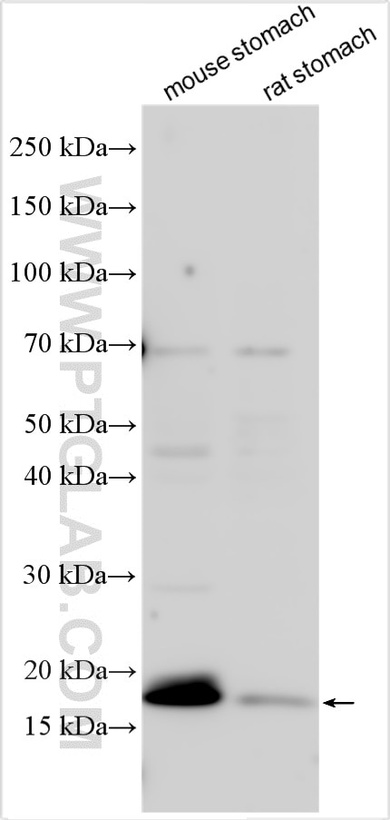 Western Blot (WB) analysis of various lysates using Gastrokine 1 Polyclonal antibody (14494-1-AP)