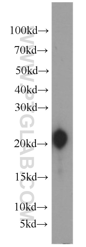 Western Blot (WB) analysis of human stomach tissue using Gastrokine 1 Polyclonal antibody (14494-1-AP)