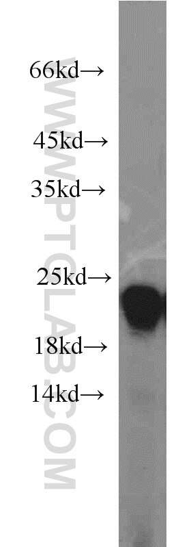 Western Blot (WB) analysis of human stomach tissue using Gastrokine 1 Polyclonal antibody (14494-1-AP)