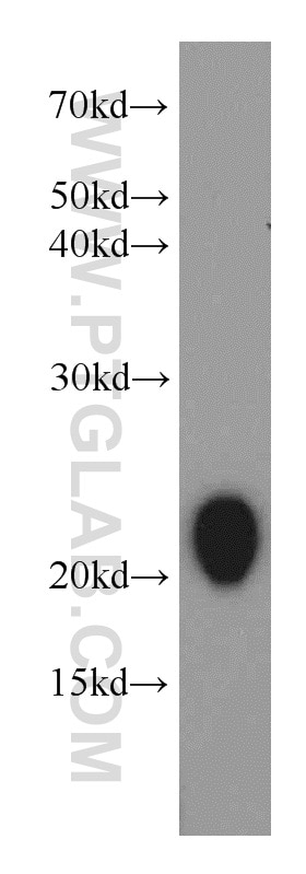 Western Blot (WB) analysis of human stomach tissue using Gastrokine 1 Polyclonal antibody (14494-1-AP)