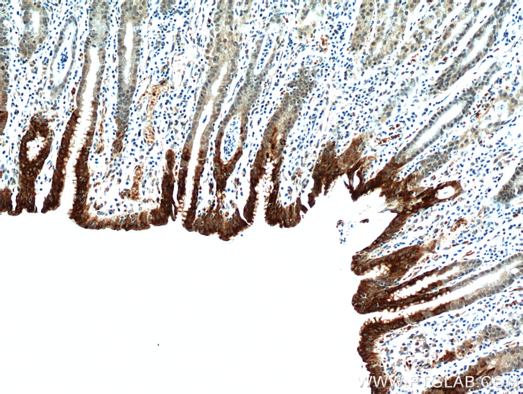 Immunohistochemistry (IHC) staining of human stomach tissue using Gastrokine 1 Polyclonal antibody (19344-1-AP)