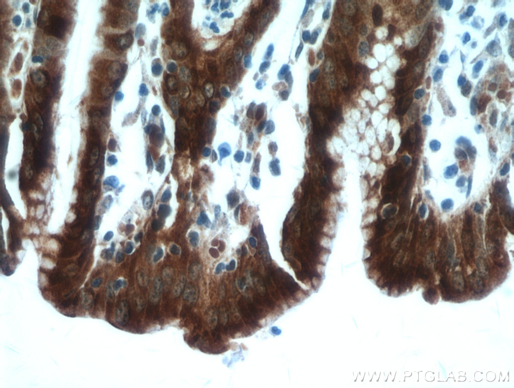 IHC staining of human stomach using 19344-1-AP