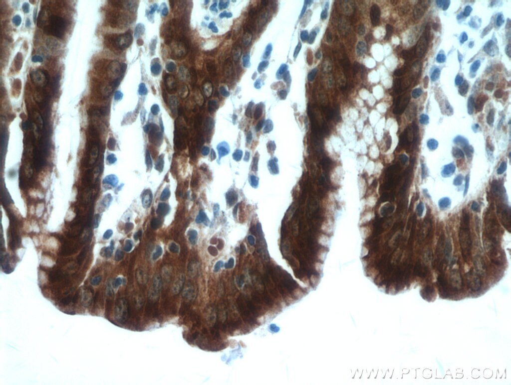 Immunohistochemistry (IHC) staining of human stomach tissue using Gastrokine 1 Polyclonal antibody (19344-1-AP)