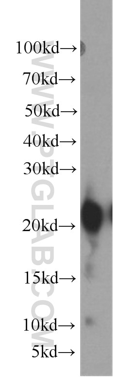 Western Blot (WB) analysis of human stomach tissue using Gastrokine 1 Polyclonal antibody (19344-1-AP)