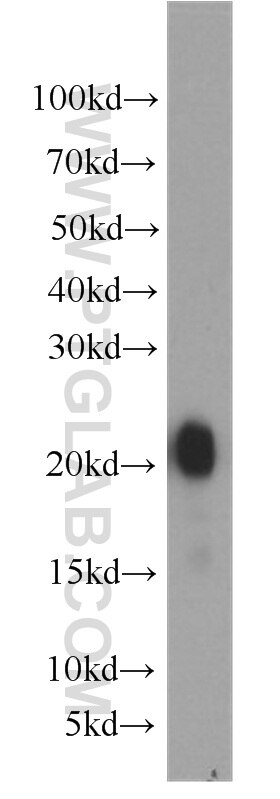 Western Blot (WB) analysis of human stomach tissue using Gastrokine 1 Polyclonal antibody (19344-1-AP)