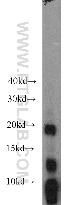Western Blot (WB) analysis of mouse stomach tissue using Gastrokine 1 Polyclonal antibody (19344-1-AP)