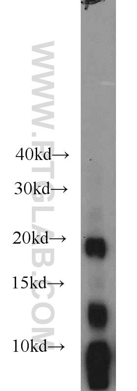 WB analysis of mouse stomach using 19344-1-AP