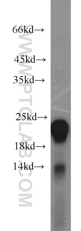 Western Blot (WB) analysis of human stomach tissue using Gastrokine 1 Polyclonal antibody (19344-1-AP)