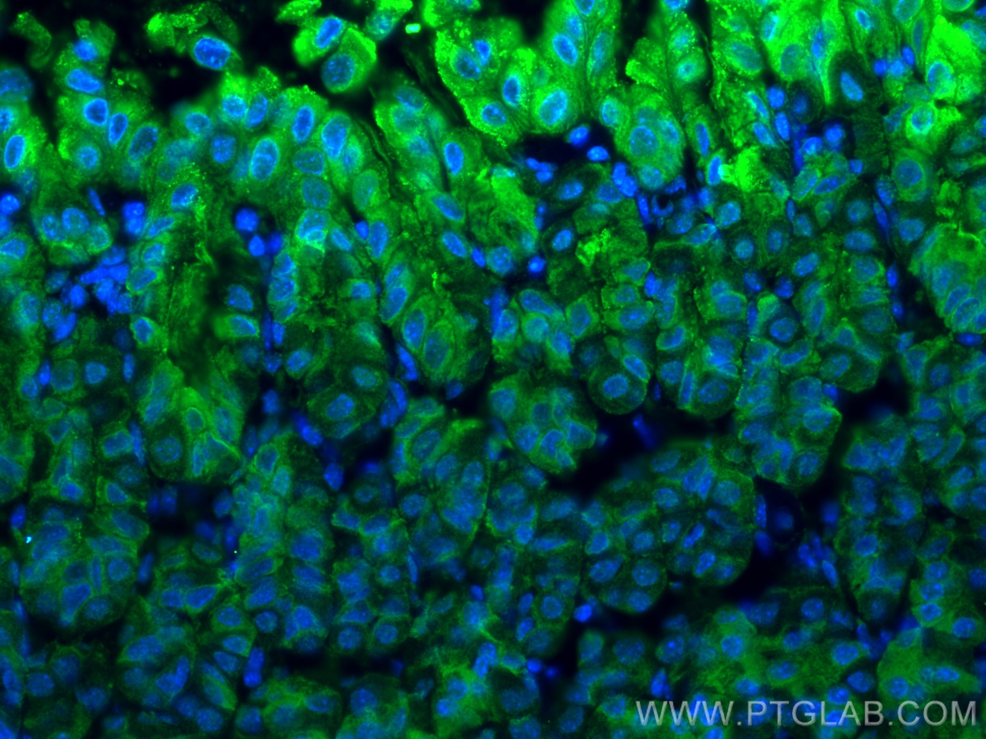 Immunofluorescence (IF) / fluorescent staining of mouse stomach tissue using Gastrokine 1 Monoclonal antibody (60130-1-Ig)