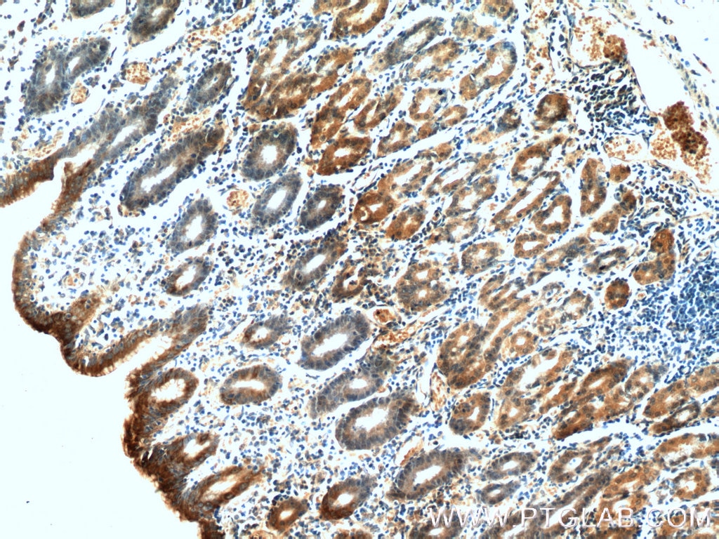 Immunohistochemistry (IHC) staining of human stomach tissue using Gastrokine 1 Monoclonal antibody (60130-1-Ig)