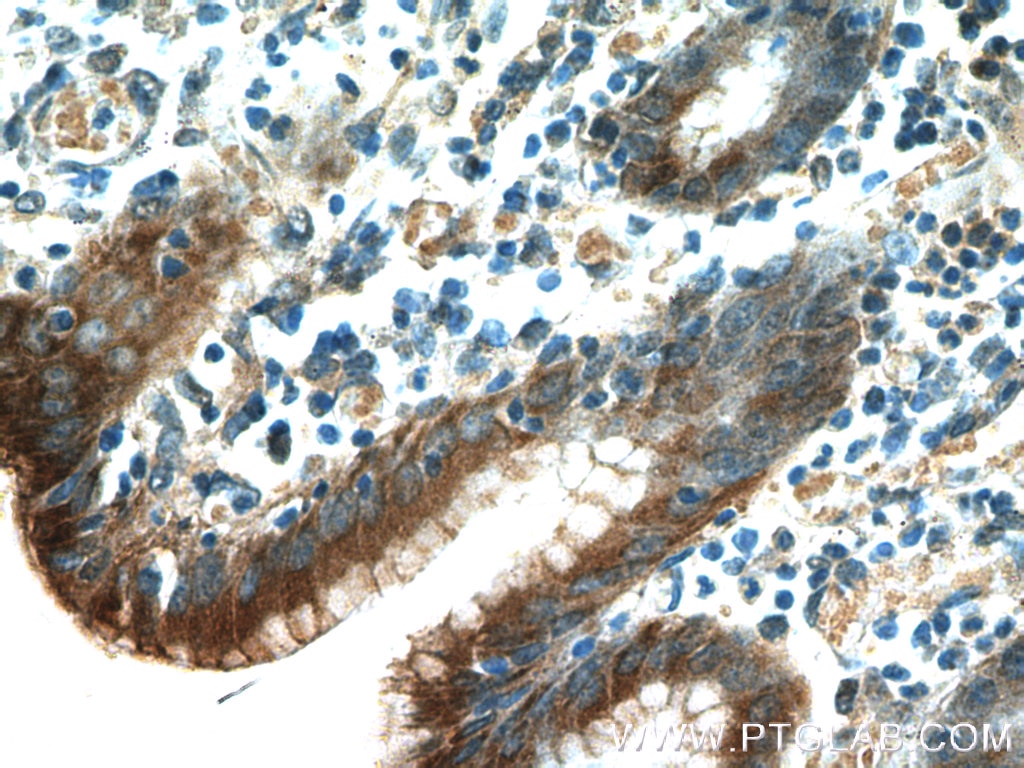 Immunohistochemistry (IHC) staining of human stomach tissue using Gastrokine 1 Monoclonal antibody (60130-1-Ig)