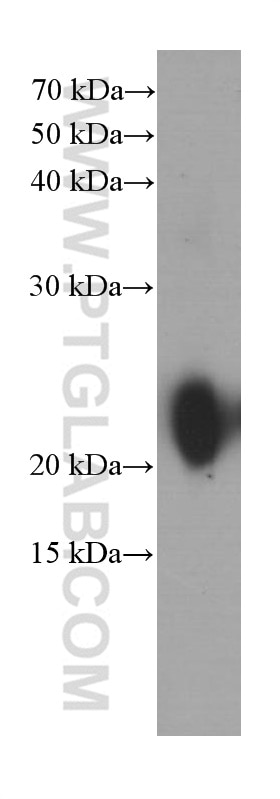 Western Blot (WB) analysis of rat stomach tissue using Gastrokine 1 Monoclonal antibody (60130-1-Ig)