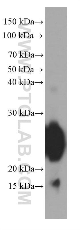 Western Blot (WB) analysis of human stomach tissue using Gastrokine 1 Monoclonal antibody (60130-1-Ig)