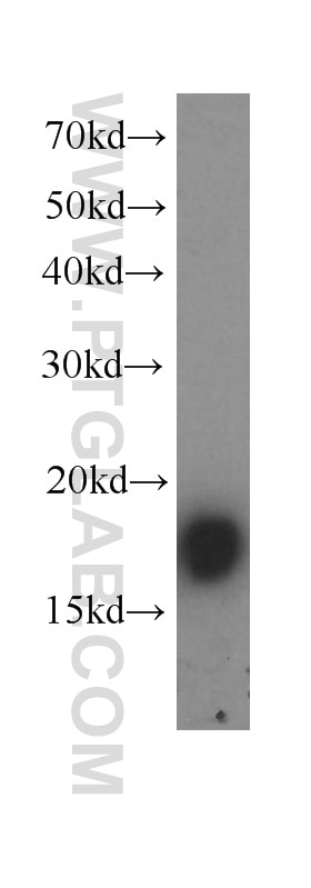 Gastrokine 1