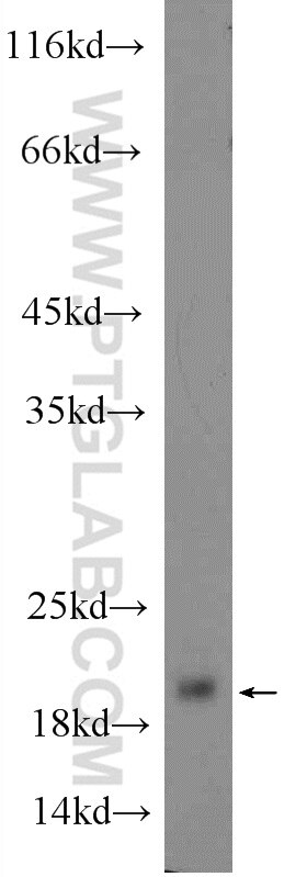 Western Blot (WB) analysis of mouse stomach tissue using GKN2 Polyclonal antibody (24651-1-AP)