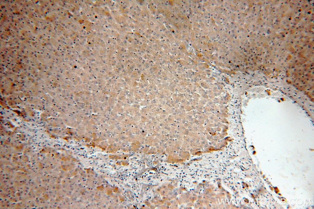 Immunohistochemistry (IHC) staining of human liver tissue using Alpha Galactosidase A Polyclonal antibody (15428-1-AP)