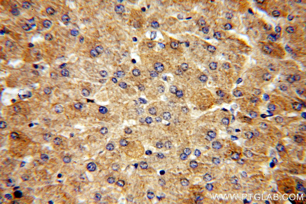 Immunohistochemistry (IHC) staining of human liver tissue using Alpha Galactosidase A Polyclonal antibody (15428-1-AP)