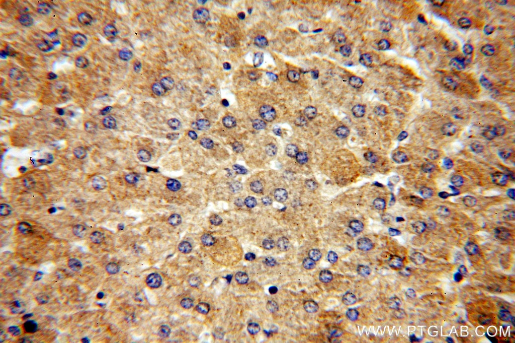 IHC staining of human liver using 15428-1-AP