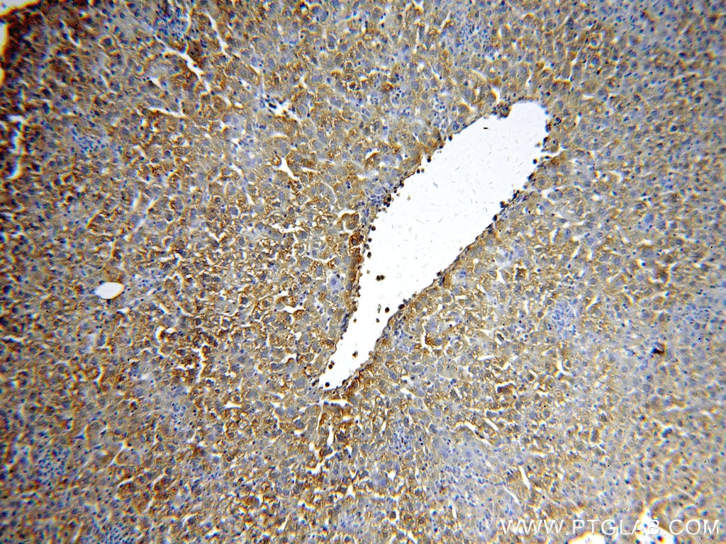 Immunohistochemistry (IHC) staining of mouse liver tissue using Alpha Galactosidase A Polyclonal antibody (15428-1-AP)