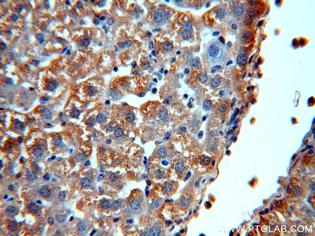 Immunohistochemistry (IHC) staining of mouse liver tissue using Alpha Galactosidase A Polyclonal antibody (15428-1-AP)