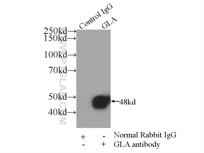 Immunoprecipitation (IP) experiment of HEK-293 cells using Alpha Galactosidase A Polyclonal antibody (15428-1-AP)