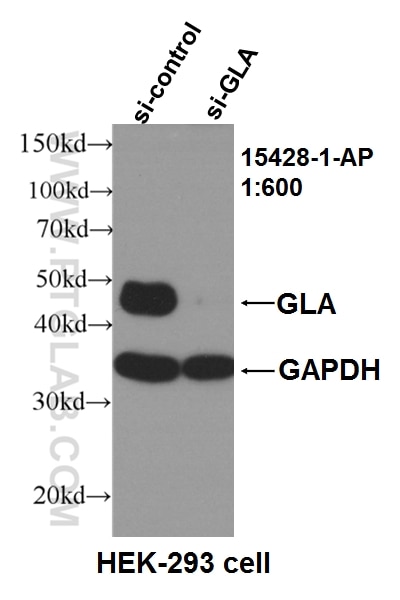 Western Blot (WB) analysis of HEK-293 cells using Alpha Galactosidase A Polyclonal antibody (15428-1-AP)