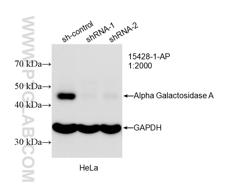 Western Blot (WB) analysis of HeLa cells using Alpha Galactosidase A Polyclonal antibody (15428-1-AP)
