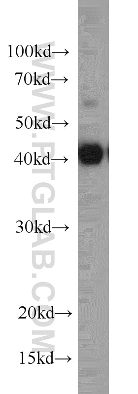 Western Blot (WB) analysis of HEK-293 cells using Alpha Galactosidase A Polyclonal antibody (15428-1-AP)