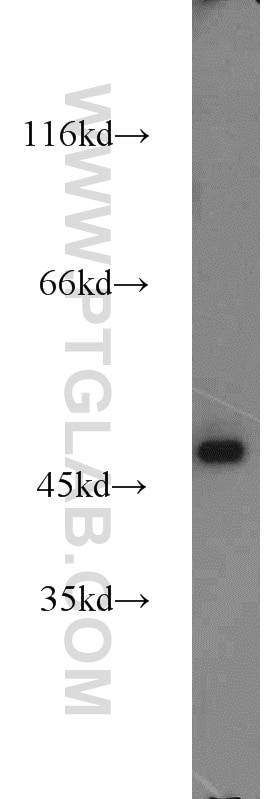 Western Blot (WB) analysis of HeLa cells using Alpha Galactosidase A Polyclonal antibody (15428-1-AP)