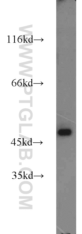 WB analysis of HeLa using 15428-1-AP