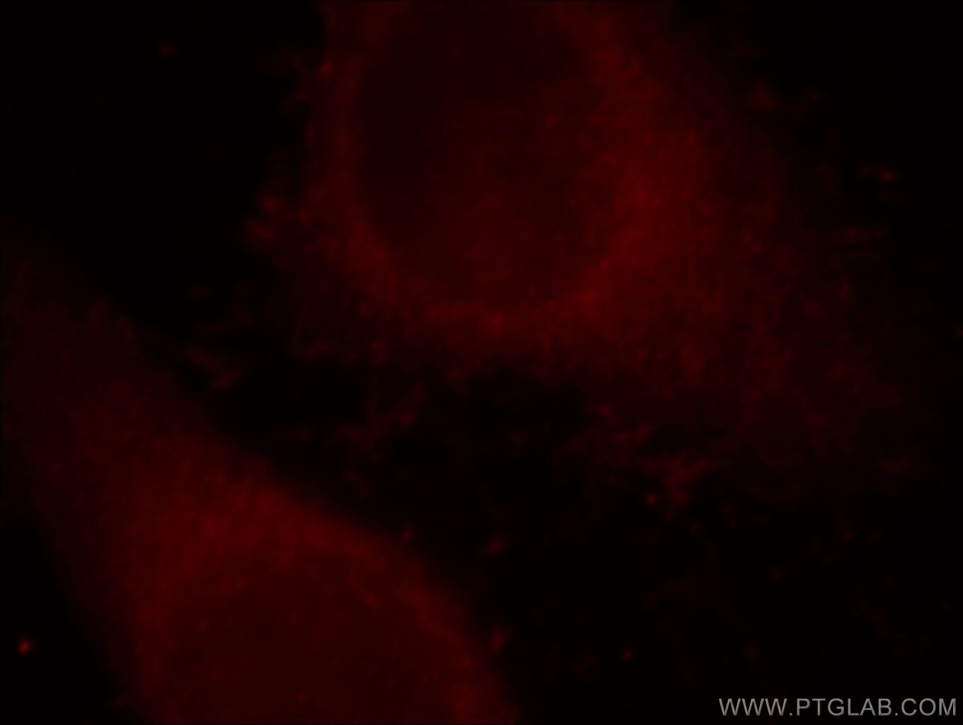 Immunofluorescence (IF) / fluorescent staining of HepG2 cells using Alpha galactosidase A Polyclonal antibody (19877-1-AP)