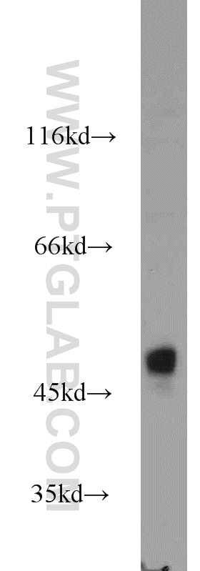 Western Blot (WB) analysis of HEK-293 cells using Alpha galactosidase A Polyclonal antibody (19877-1-AP)