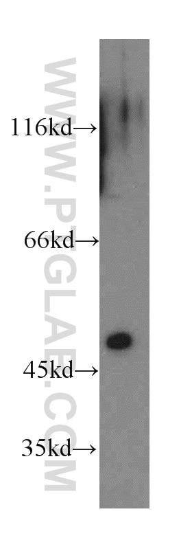 Western Blot (WB) analysis of HEK-293 cells using Alpha galactosidase A Polyclonal antibody (19877-1-AP)