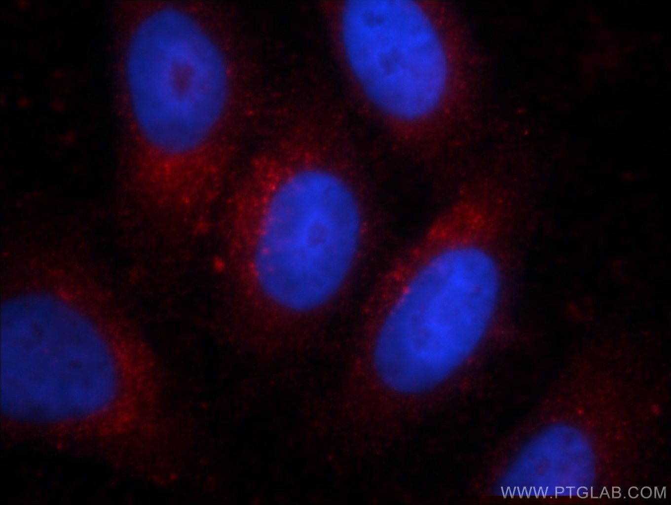 Immunofluorescence (IF) / fluorescent staining of HepG2 cells using Alpha Galactosidase A Monoclonal antibody (66121-1-Ig)