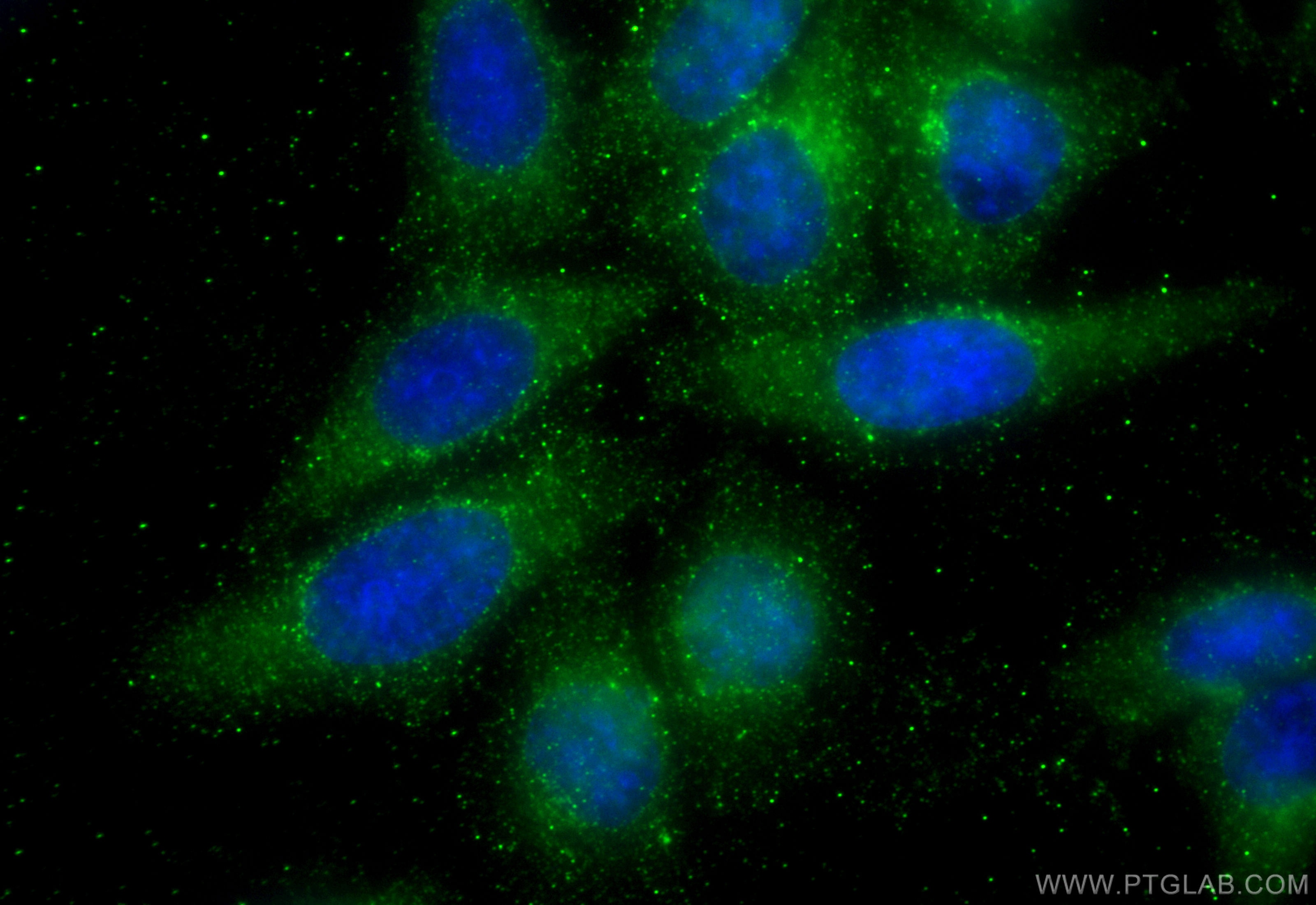 Immunofluorescence (IF) / fluorescent staining of HepG2 cells using Alpha Galactosidase A Monoclonal antibody (66121-1-Ig)
