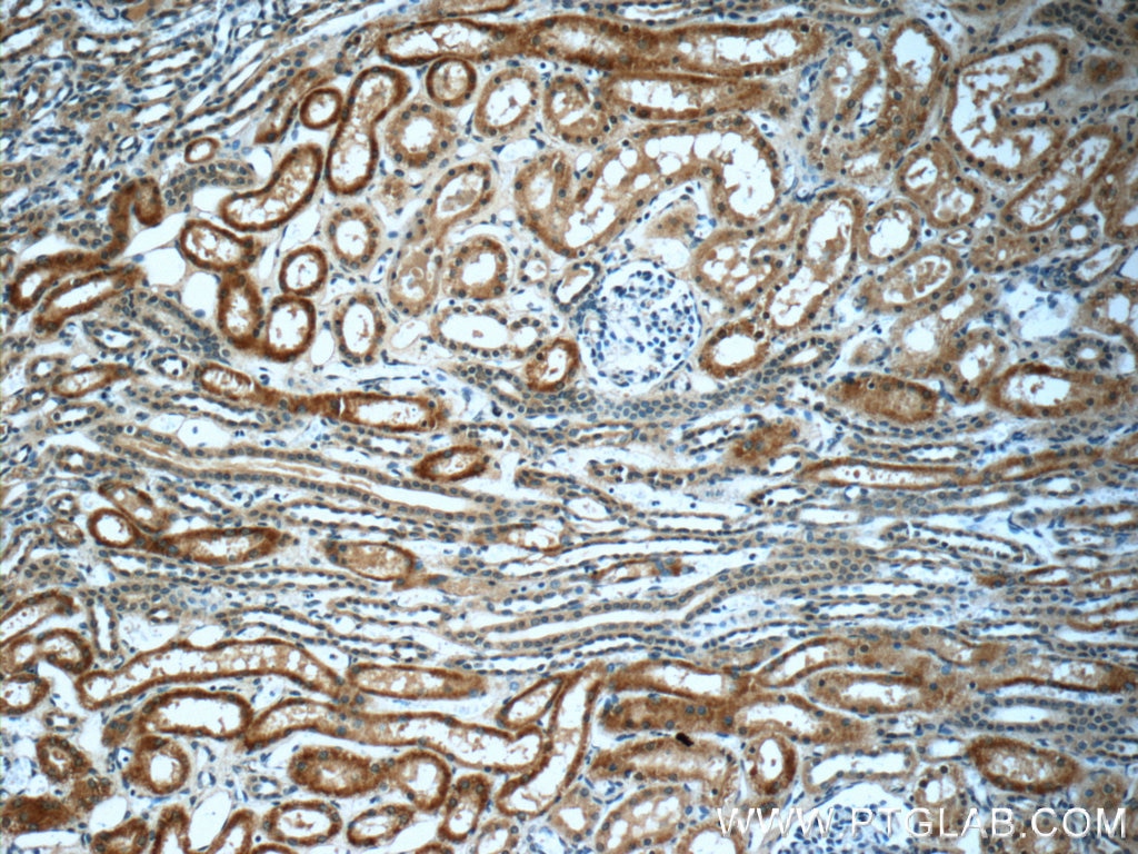Immunohistochemistry (IHC) staining of human kidney tissue using Alpha Galactosidase A Monoclonal antibody (66121-1-Ig)
