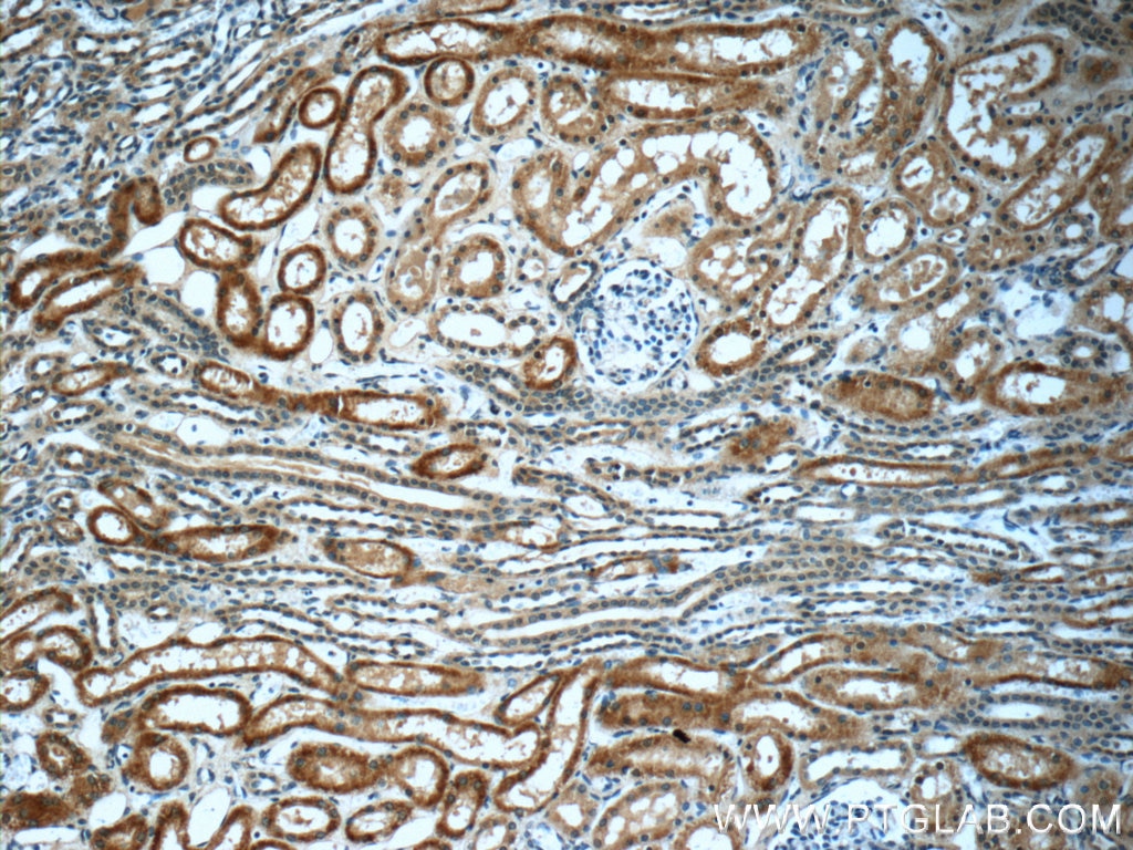 IHC staining of human kidney using 66121-1-Ig