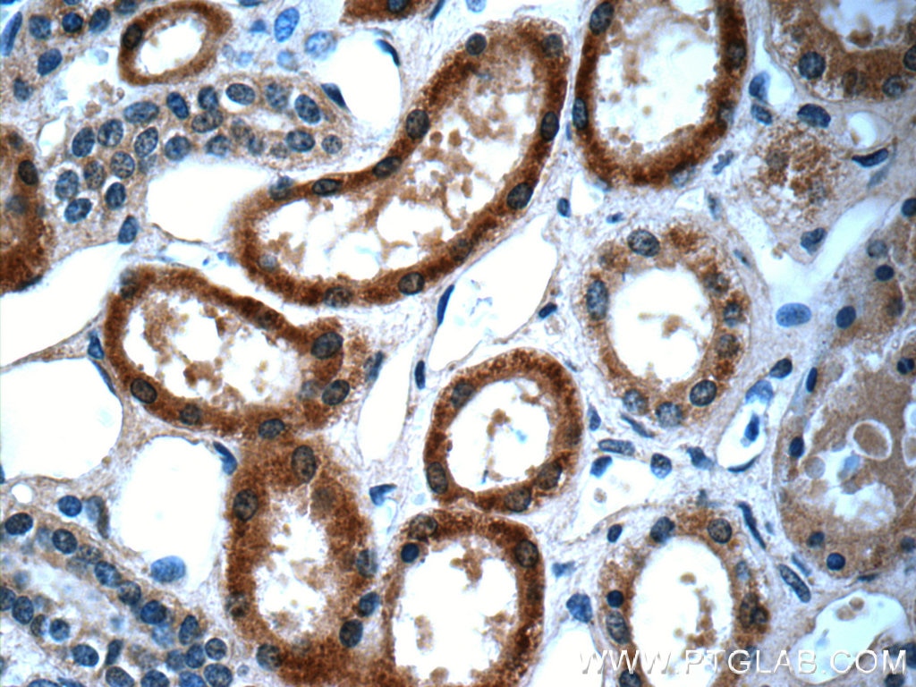 Immunohistochemistry (IHC) staining of human kidney tissue using Alpha Galactosidase A Monoclonal antibody (66121-1-Ig)