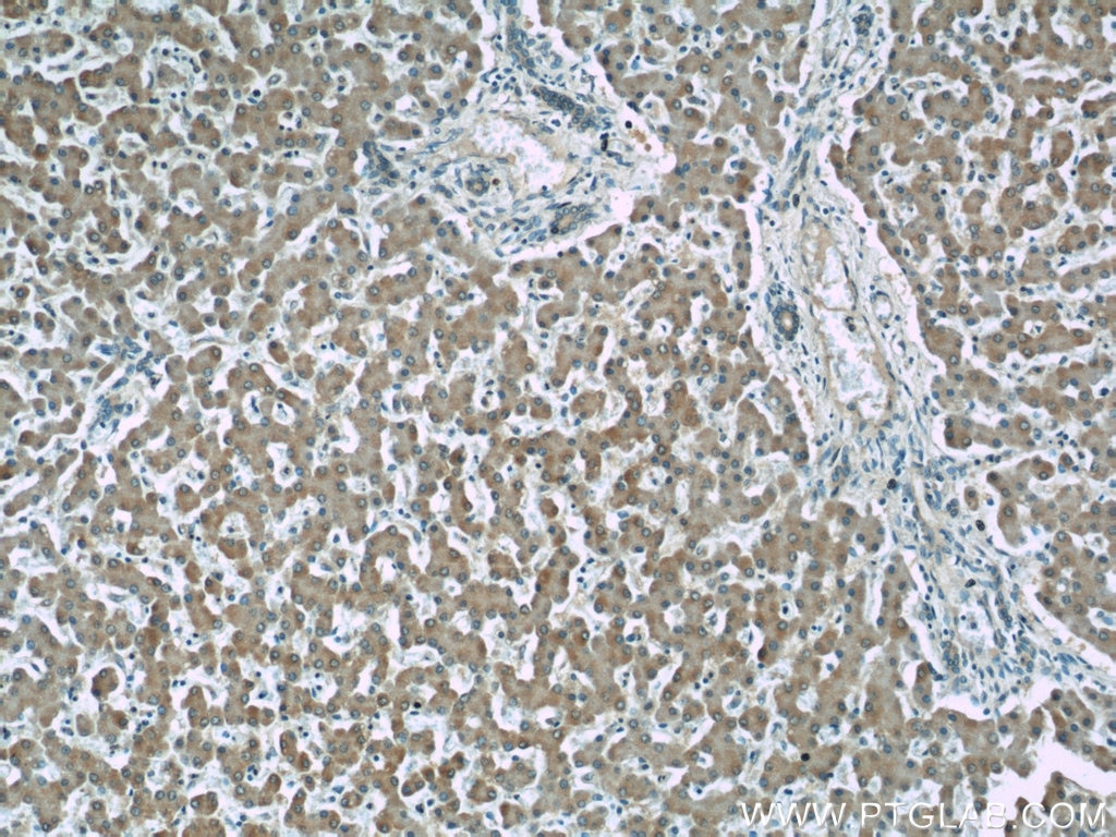 Immunohistochemistry (IHC) staining of human liver tissue using Alpha Galactosidase A Monoclonal antibody (66121-1-Ig)