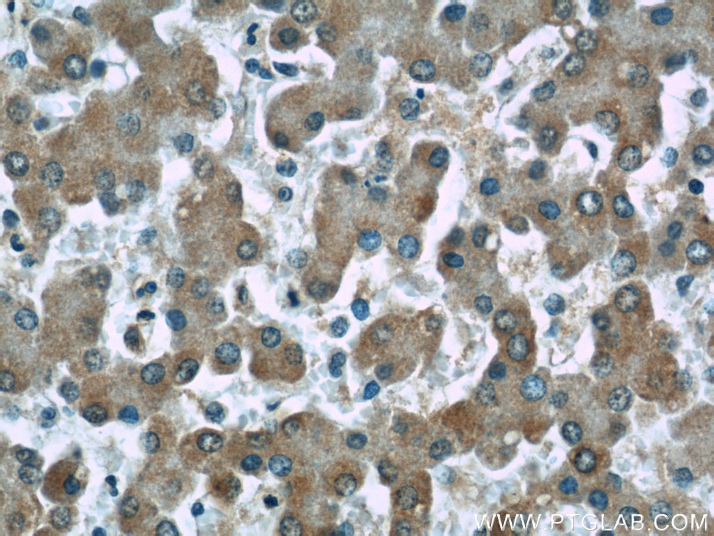 Immunohistochemistry (IHC) staining of human liver tissue using Alpha Galactosidase A Monoclonal antibody (66121-1-Ig)