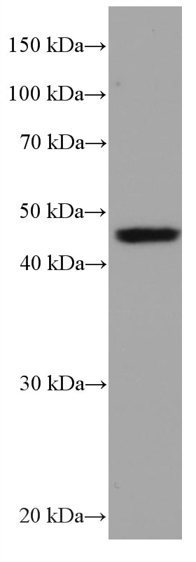 Western Blot (WB) analysis of LNCaP cells using Alpha Galactosidase A Monoclonal antibody (66121-1-Ig)